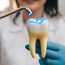 dentist using light to cure tooth-colored filling in Evanston